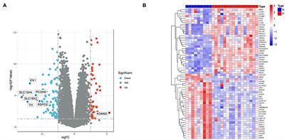 Identification of hub genes of Parkinson's disease through bioinformatics analysis